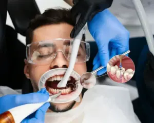 root canal procedure