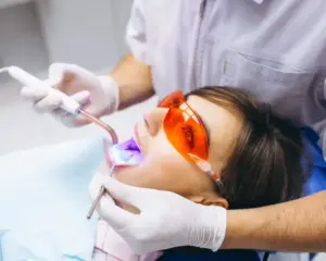 professional teeth whitening